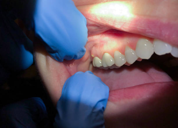 Best Cosmetic Emergency Dentistry in Stallings, NC