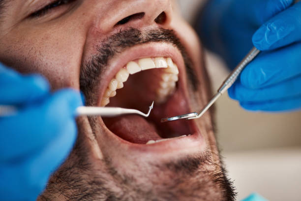 Best Pediatric Emergency Dentist in Stallings, NC