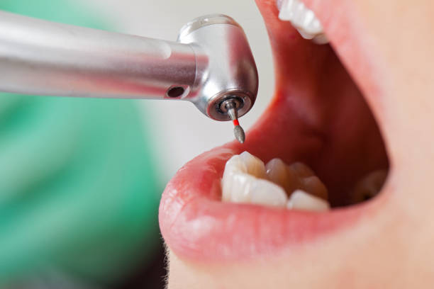 Best Same-Day Emergency Dental Services in Stallings, NC